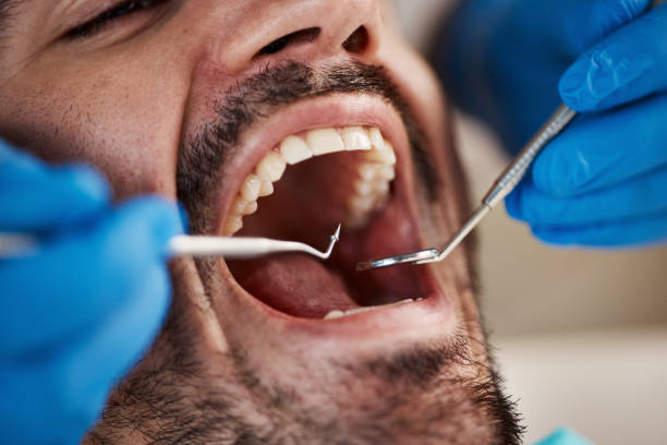 Emergency Gum Pain Relief in KY