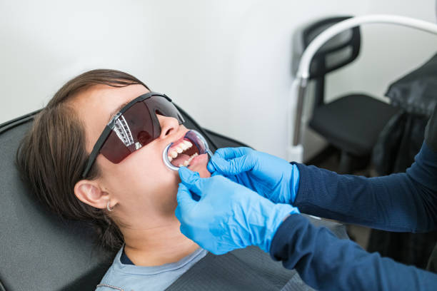 Teeth Whitening in KY